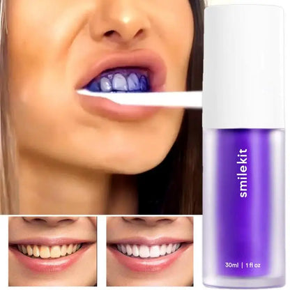 SmileKit v34